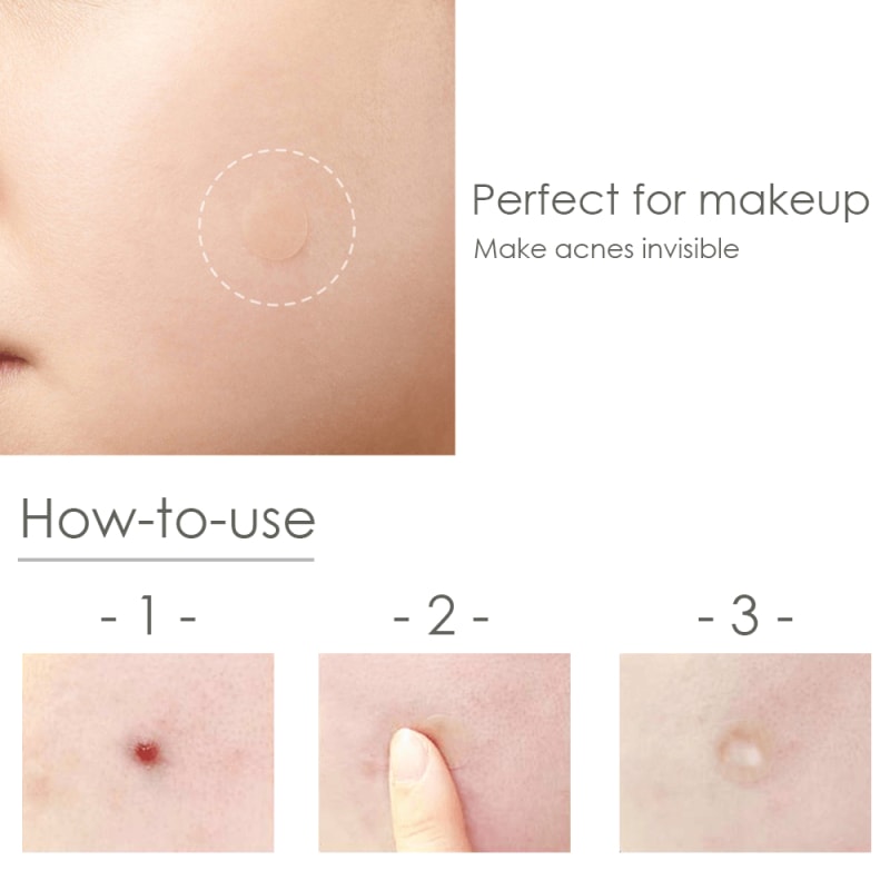 Beauty Acne Patch Set (24 Pcs) - Dilutee.com